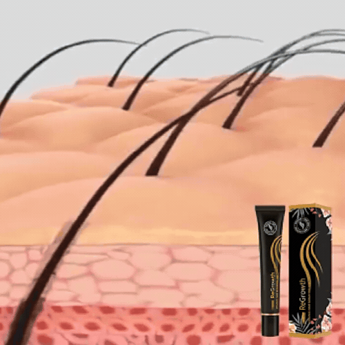 ForceRacine – Sérum Densifiant Cuir Chevelu + Roller Applicateur