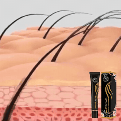 ForceRacine – Sérum Densifiant Cuir Chevelu + Roller Applicateur
